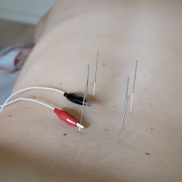 PIEL DESHIDRATADA-20